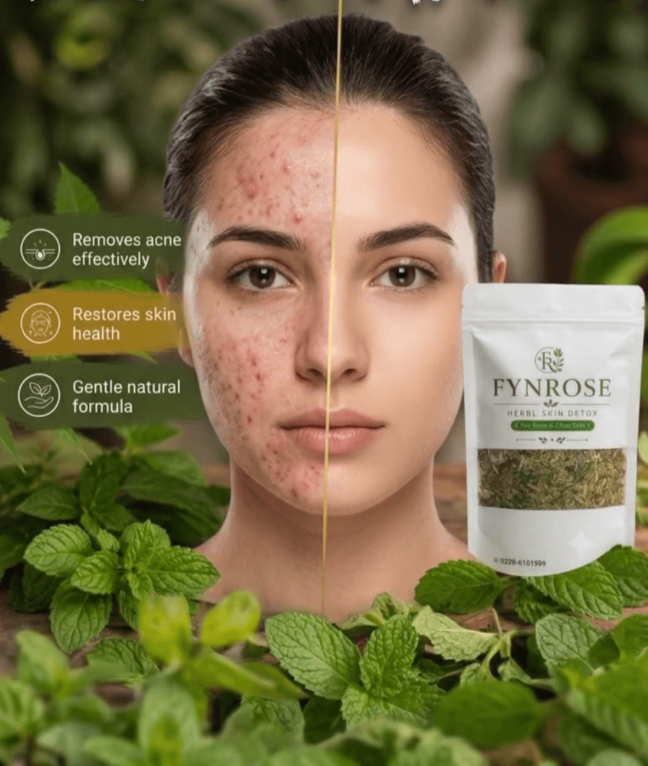Before and after: acne prone skin becoming clear after a Fynrose detox cycle